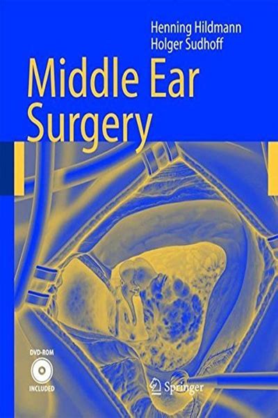 Middle Ear Surgery By Henning Hildmann Springer Middle Ear Surgery