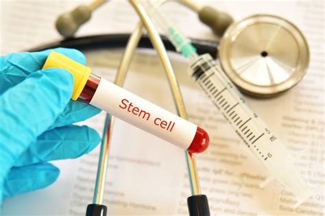 Stem Cell Uses Sources Therapy Extensive Research And Controversy