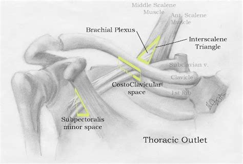 Thoracic Outlet Syndrome Tos Baseline Health And Wellness