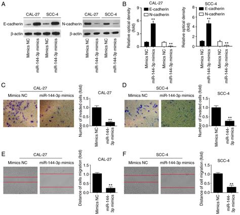 mir‑144‑3p inhibits tumor cell growth and invasion in oral squamous cell carcinoma through the