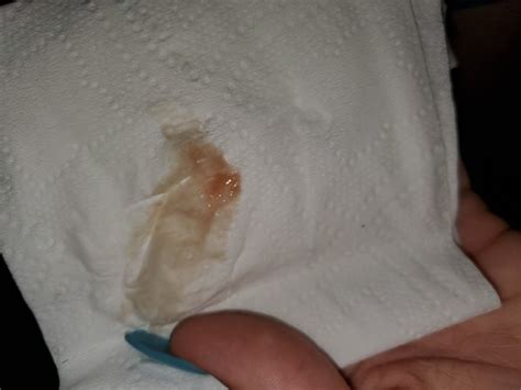 Ovulation Or Implantation Bleeding Pictures Babycenter