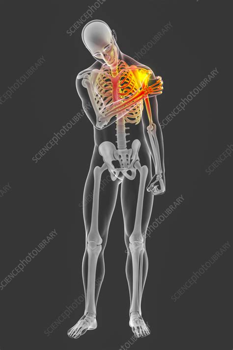 Painful Shoulder Illustration Stock Image F0356350 Science