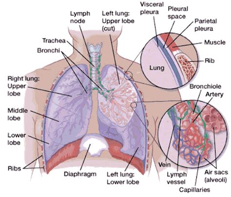 Pleural Effusion Causes Types Symptoms Diagnosis And Treatment