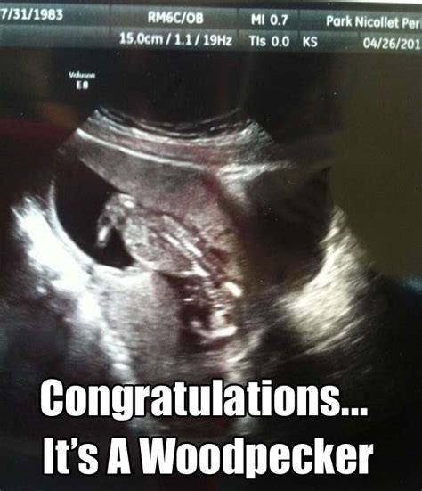 20 of the funniest ultrasound pictures…