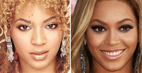 Beyonce Plastic Surgery Before And After Nose Job Botox