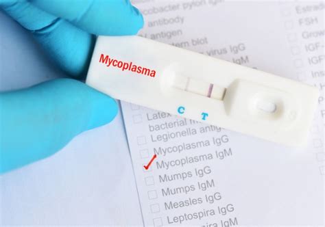 Mycoplasma Genitalium Diagnóstico Y Tratamiento Artículos Intramed