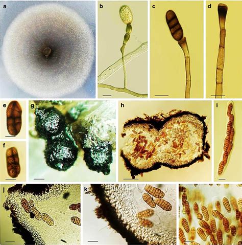 Stemphylium Vesicarium A Colony On Pca B F Conidia And