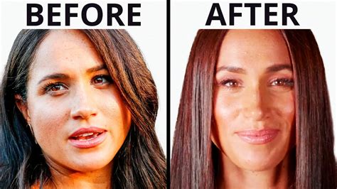 Meghan Markles Royal Transformation Plastic Surgery Analysis Youtube