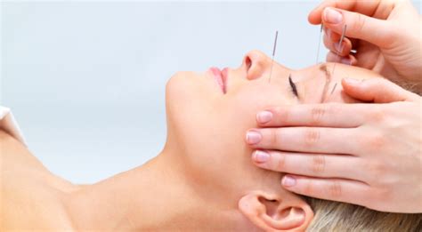 Facial Acupuncture And Massage