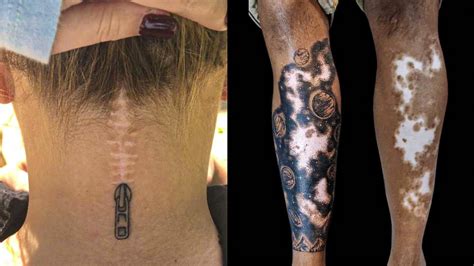 Wonderful Tattoos That Turn Scars Into Works Of Art Youtube