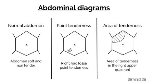 Abdomen Diagram