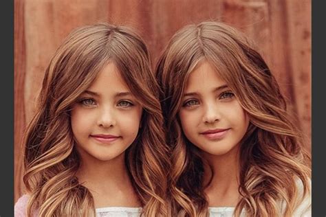 Conoce a las gemelas más bonitas del mundo