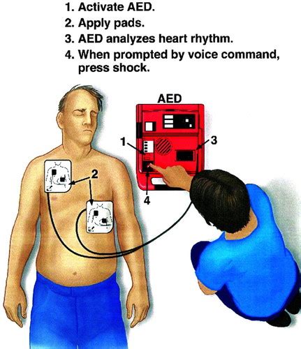 Automated External Defibrillators In The Public Domain Circulation
