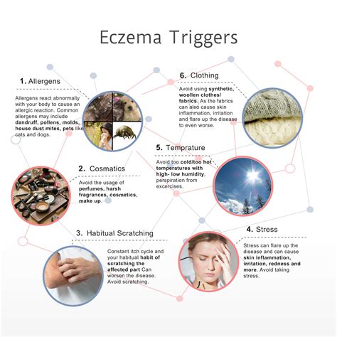 8 Most Common Eczema Triggers In 2019 An Infographic Eczema