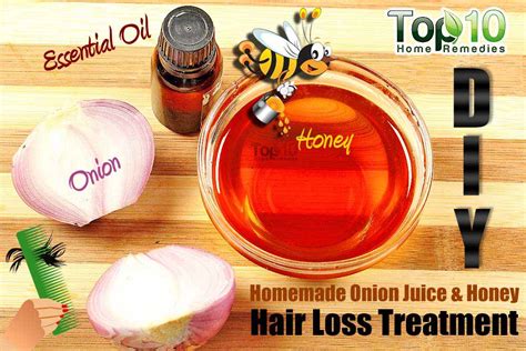 Diy Homemade Onion Juice And Honey Hair Loss Treatment Top 10 Home