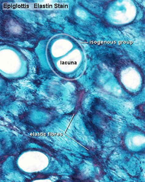 Anat2241 Connective Tissue Components Embryology