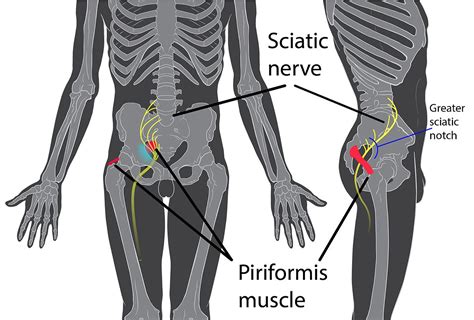 The human back, also called the dorsum, is the large posterior area of the human body, rising from the top of the buttocks to the back of the neck. Piriformis syndrome - Wikipedia