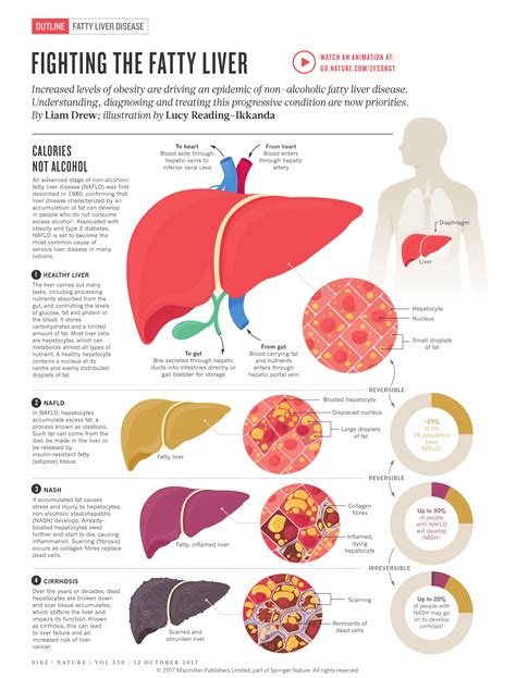 Understanding Fatty Liver Disease And Visually
