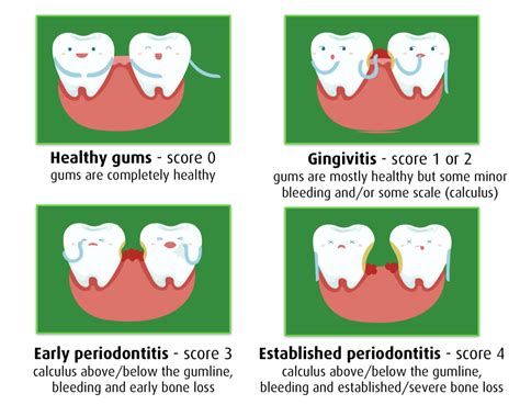 Gum Health ﻿﻿london Bridge Dental Health Bermondsey