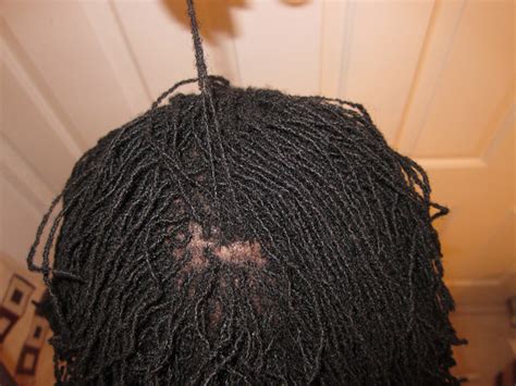 And some could be leaving permanent damage. Kreyola's Journeys: Snapping Locks vs Thinning Locks ...