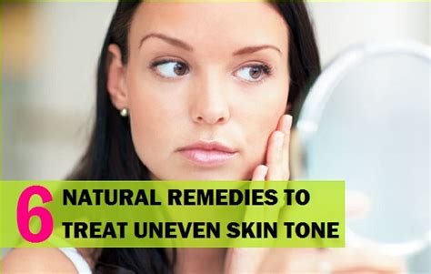 6 Best Natural Remedies To Treat Uneven Skin Tone On Face