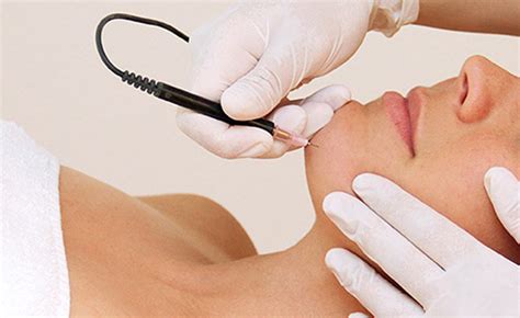 Permanent Hair Removal Guide Harmony Beauty Therapy