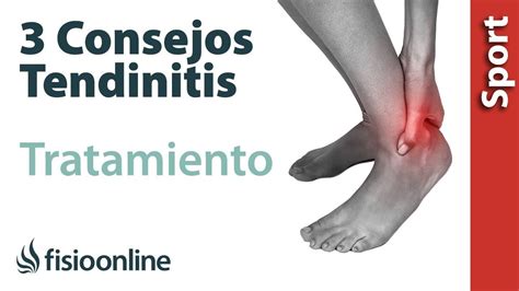 Tendinitis Tres Cosas Que Debes Conocer Sobre Sus Causas Y El