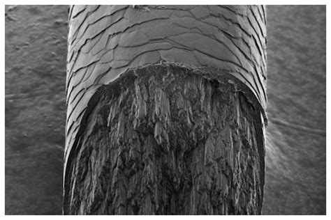 I don't understand why i haven't noticed it before. X-Ray reveals mysterious component of human hair ...