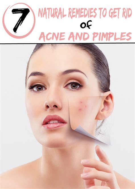 7 Natural Remedies To Get Rid Of Acne And Pimples Healthamania