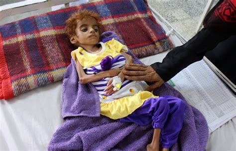 Yemen On Verge Of Worst Famine In 100 Years As Civil War Rages On