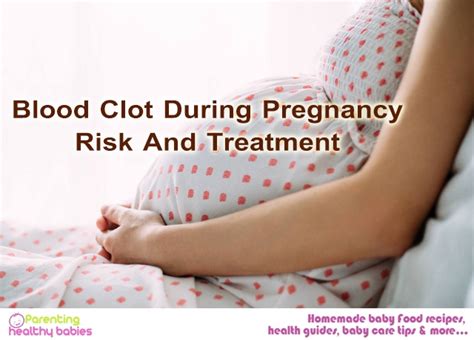 Blood Clot During Pregnancy Risk And Treatment