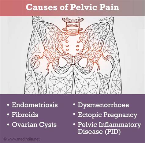 Pelvic Ct Scan Causes Symptoms Treatment Pelvic Ct Scan