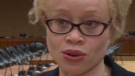 Especialista Da Onu Revela Aumento De Ataques A Albinos Maior Parte