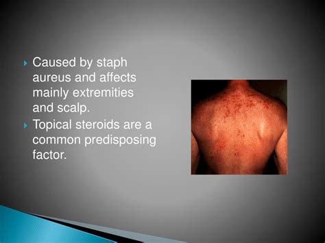 Ppt Bacterial Skin Infection Powerpoint Presentation Free Download