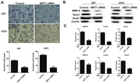 sirt1 silencing inhibits invasion of glioma cells a invasive ability download scientific