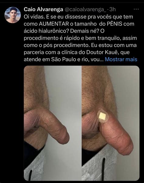 Gui Prado On Twitter Que Bizarrice Essa Gente O Pior Que N O