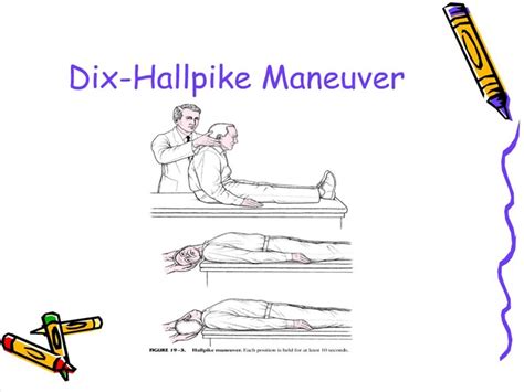 Ppt Dix Hallpike Maneuver Powerpoint Presentation Free Download Id