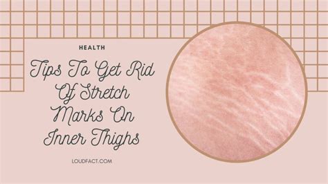 How To Get Rid Of Stretch Marks On Inner Thighs Proven Tips Loudfact
