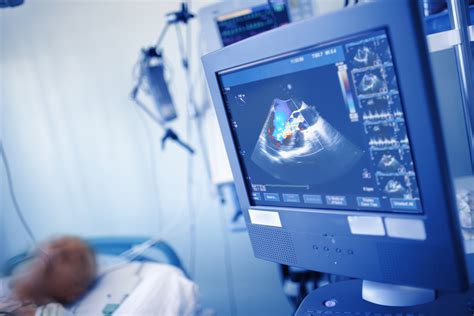 What An Echocardiogram Reveals About Your Heart Southfield Doctors