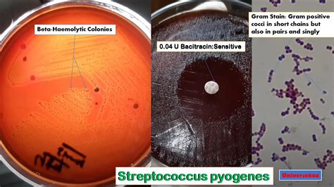 Streptococcus Pyogenes Introduction Morphology Culture Characteri