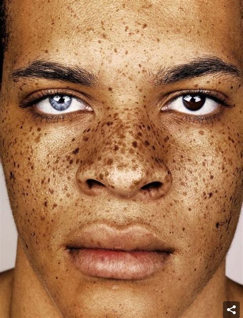 Freckled People Freckles Freckle Face Portrait