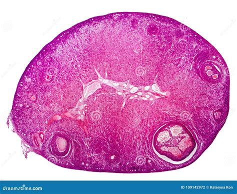 Light Micrograph Of Human Ovary Stock Photo Image Of Isolated