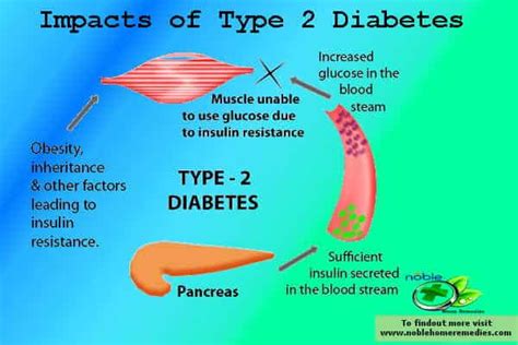 Top 8 Natural Herbs for Diabetes type 2 - Remedies