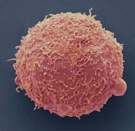 Breast Cancer Cell Photograph By Steve Gschmeissner Fine Art America