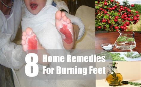 8 Home Remedies For Burning Feet Search Home Remedy
