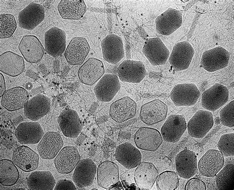 What Is Electron Microscopy And Its Applications