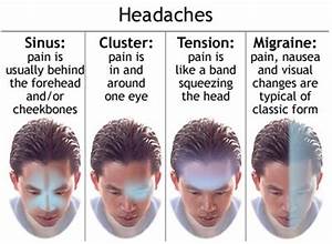 Cluster Headache Case Study Physiopedia