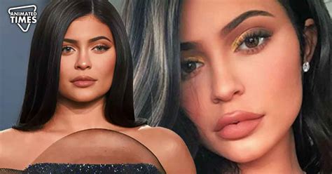 She Got Her Lip Filler Undone Kylie Jenner Regrets Her Lip Surgery