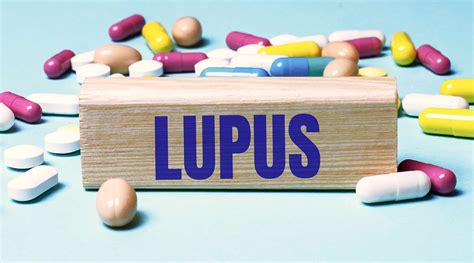 Lupus En Niños Día Mundial Del Lupus Criar Con Sentido Común