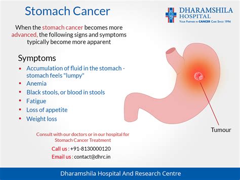 Pin On Stomach Cancer Treatment Hospitals